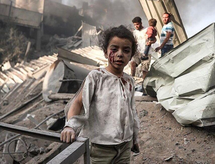 Gazze’de Açlıktan Ölen Çocuk Sayısı 121’e Yükseldi Gazze Sağlık Bakanlığı, İsrail’in gıda, su ve ilaç girişini engelleyen