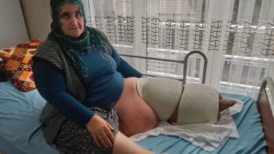 Mersin’in Tarsus ilçesinde yaşayan 53 yaşındaki kadın, 35 yıldır fil