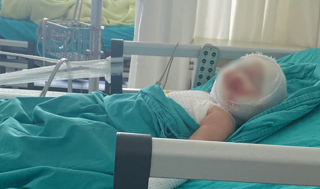 Mersin’de 9 aylıkken misafirlikte patlayan domates konservesi nedeniyle yüzü ve